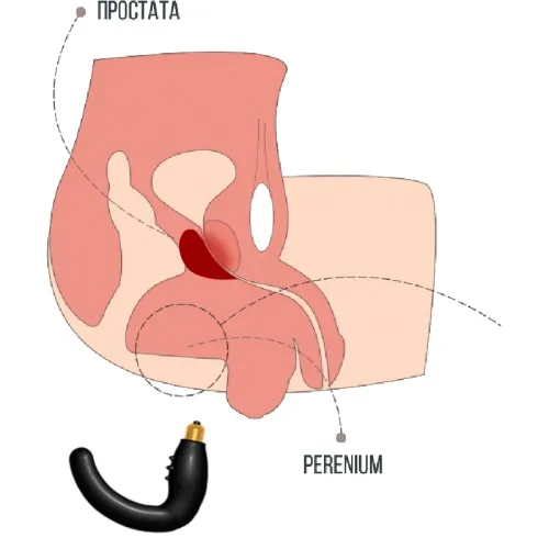 Prostamid